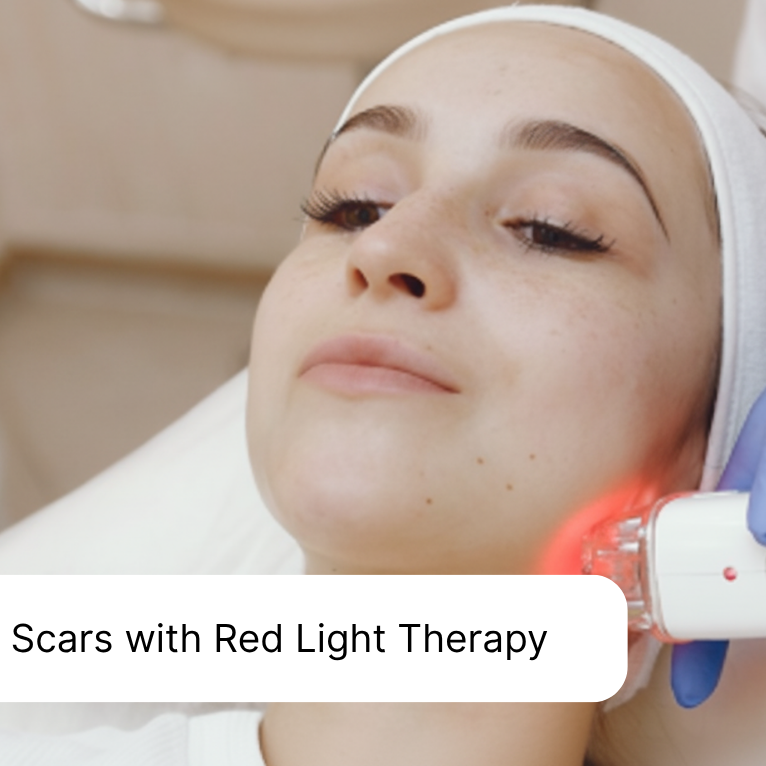 Scars with Red Light Therapy