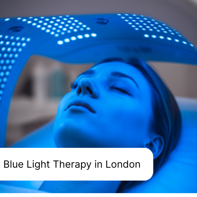 Transform Acne with Blue Light Therapy in London